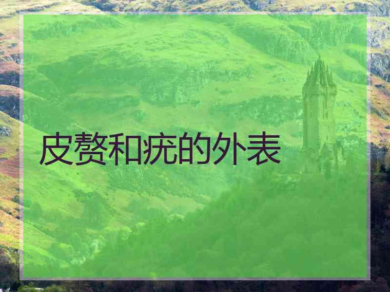 皮赘和疣的外表 皮赘和疣的外表
