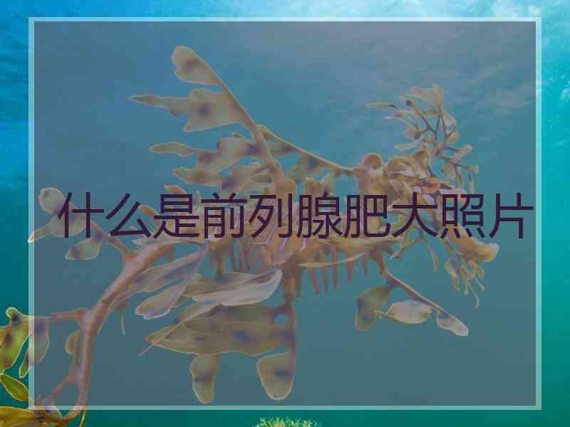 什么是前列腺肥大照片